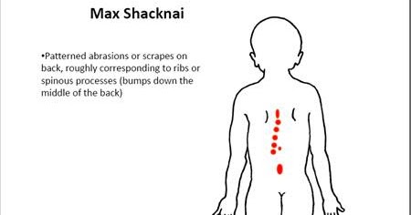 7242876172_83405daca2